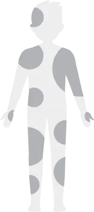 Full-body silhouette with fewer shaded areas across the body