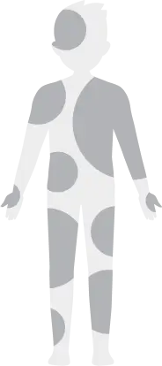 Full-body silhouette with multiple shaded areas across the body