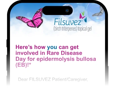 Phone screen showing a FILSUVEZ message