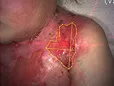 Small-10