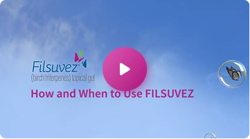 How and when to use FILSUVEZ thumbnail